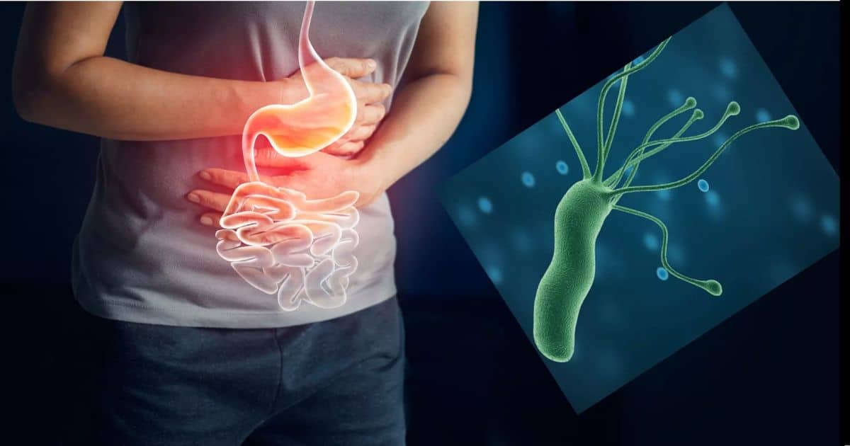 🦠Helicobacter pylori et la nutrithérapie